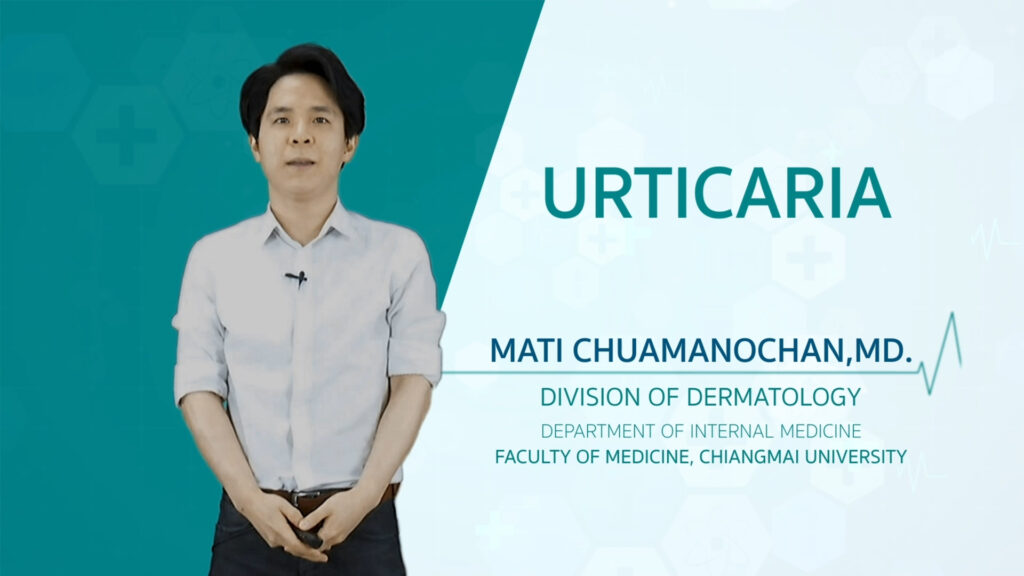 ผลงาน “Urticaria​” (improvement version) with Mati Chuamanochan, M.D. (Trailer)