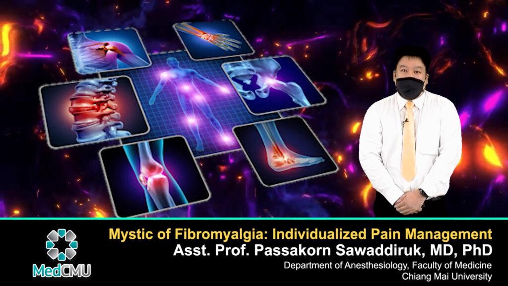 ผลงาน Mystic of Fibromyalgia: Individualized Pain Management